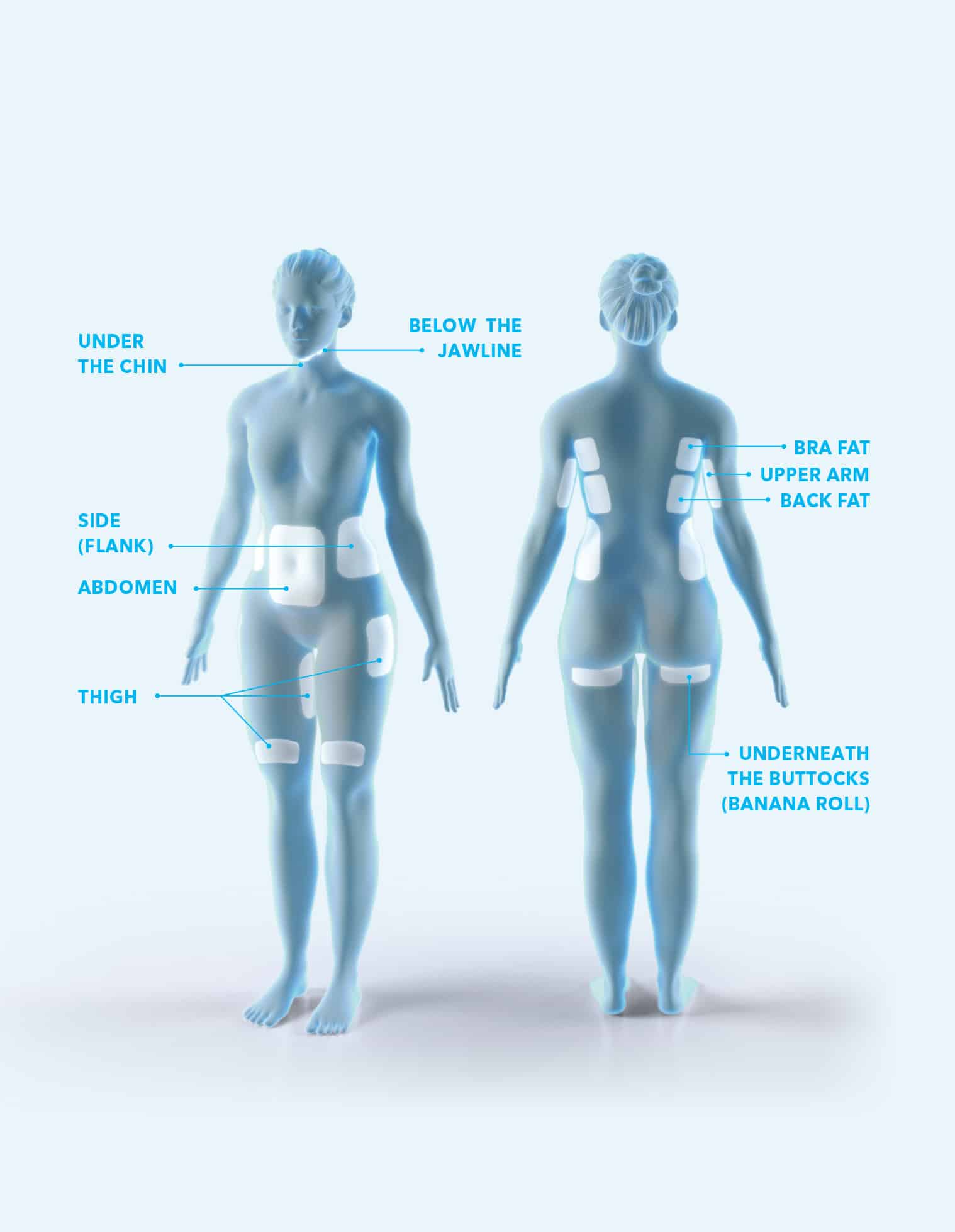 Coolsculpting 9 Treatment Areas Infographic